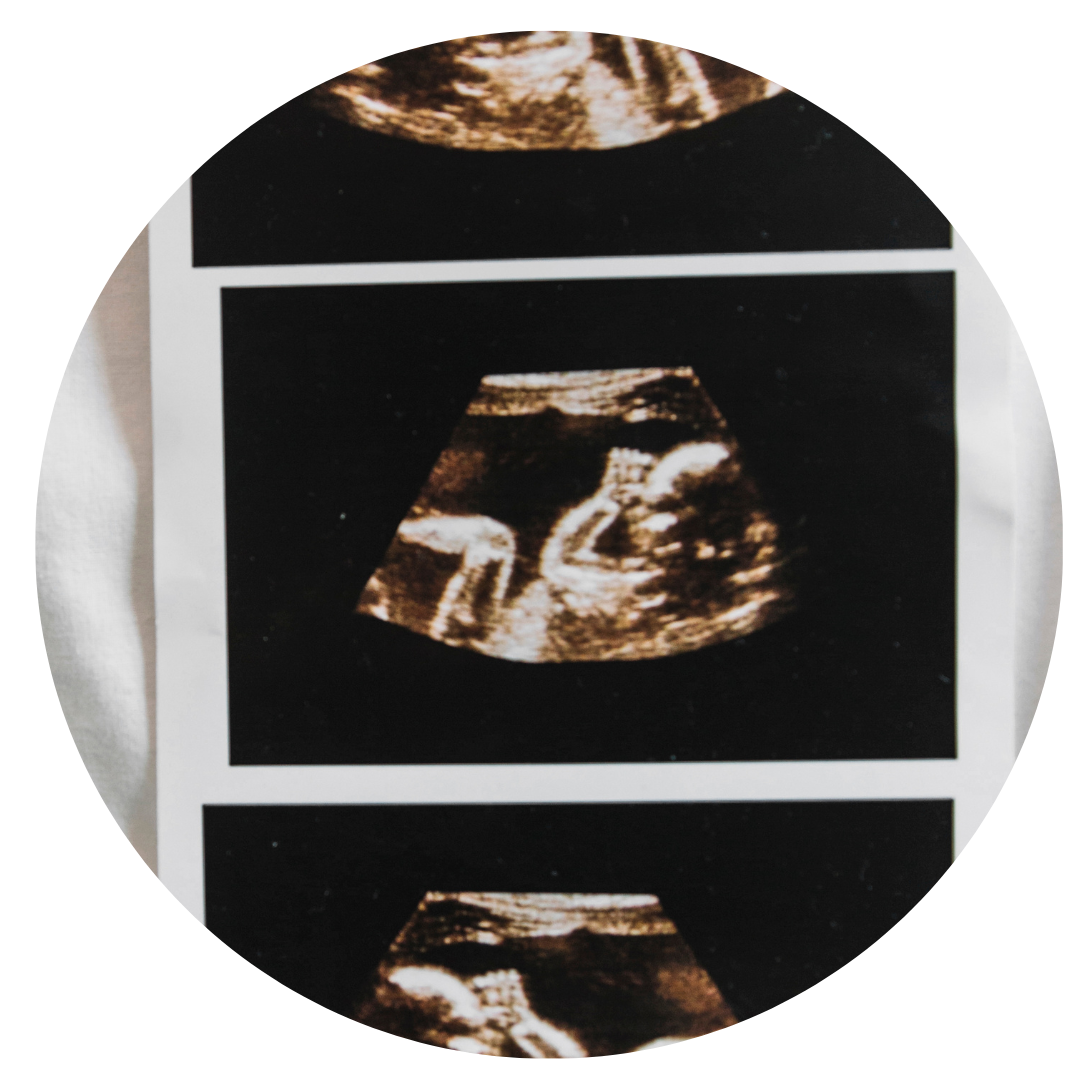 Freeport Pregnancy Center Limited Ultrasound